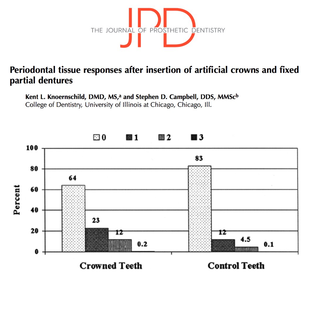 JPDentistry's tweet photo. In this #classicarticle, the gingival response around tooth-supported #dentalcrowns and the impact derived from factors like margin placement and adaptation, quality of prosthesis,  #clinicalattachmentloss, and #boneloss are evaluated. 

Learn more: https://t.co/eunENpp6Co https://t.co/msCYw1pGUX