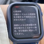 【体験済‼】 心房細動の兆候を確認したAppleWatch有能すぎる‼