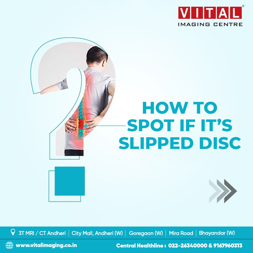 vital_imaging's tweet photo. Pain and numbness in only one side of your body is unusual if it's on a regular basis. Get your screening done for perfect diagnosis and medication.

#vital #vitalimaging #ctscan #medicalscan #radiology #sonography #mri #mriscan #xrays #ultrasound #3TMR #3D #diagnosis https://t.co/2IjZXdgjay