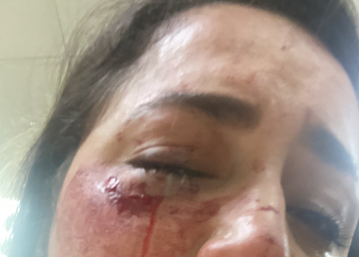 laverocarrillo's tweet photo. Acabo de de víctima de un asalto con arma  el día de hoy, @LassoGuillermo  y dígame señor presidente cuántas personas más tendrán que pasar para que se dé cuenta de lo que estamos viviendo! https://t.co/nPJUwWBDgf