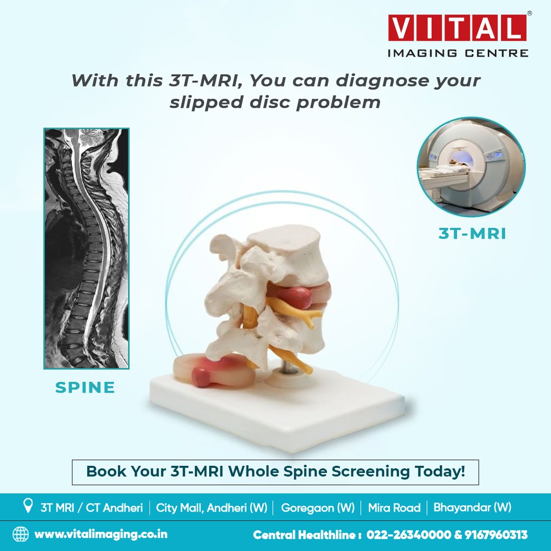 vital_imaging's tweet photo. Pain and numbness in only one side of your body is unusual if it's on a regular basis. Get your screening done for perfect diagnosis and medication.

#vital #vitalimaging #ctscan #medicalscan #radiology #sonography #mri #mriscan #xrays #ultrasound #3TMR #3D #diagnosis https://t.co/2IjZXdgjay