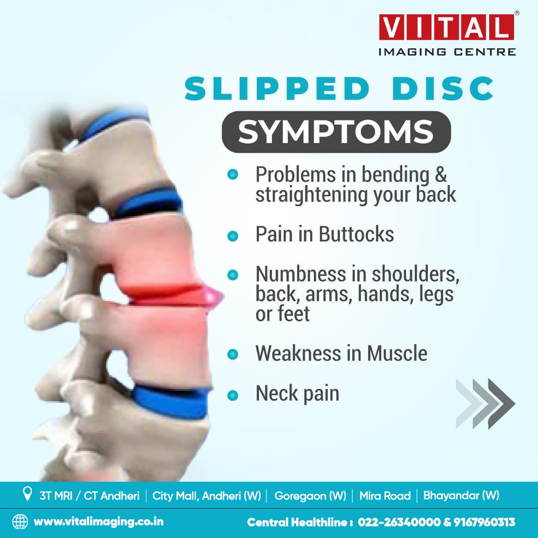 vital_imaging's tweet photo. Pain and numbness in only one side of your body is unusual if it's on a regular basis. Get your screening done for perfect diagnosis and medication.

#vital #vitalimaging #ctscan #medicalscan #radiology #sonography #mri #mriscan #xrays #ultrasound #3TMR #3D #diagnosis https://t.co/2IjZXdgjay