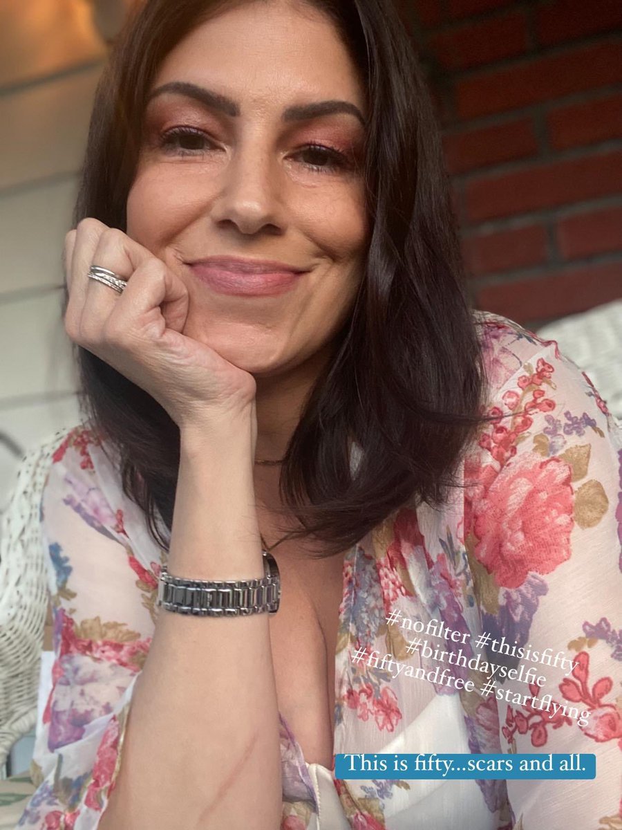 lisalgentile's tweet photo. This is fifty…scars and all. So grateful to have come this far and for everyone who has helped me get here! Thank you for all of the birthday love. Start Flying 🕊

#nofilter #thisisfifty #birthdayselfie #fiftyandfree #startflying https://t.co/Xxy8TP5rYd