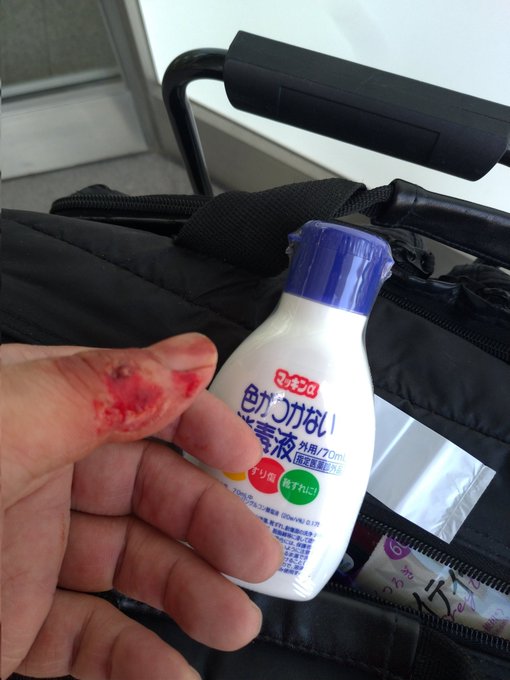 キズ写真はTwitterにアップすると一種のグロ画像だよなぁと思って上げてなかったんだけど、そういえばセンシティブ設定すればワンクッション置かれた上にメディア欄にも置かれないのか。直後と6日後 