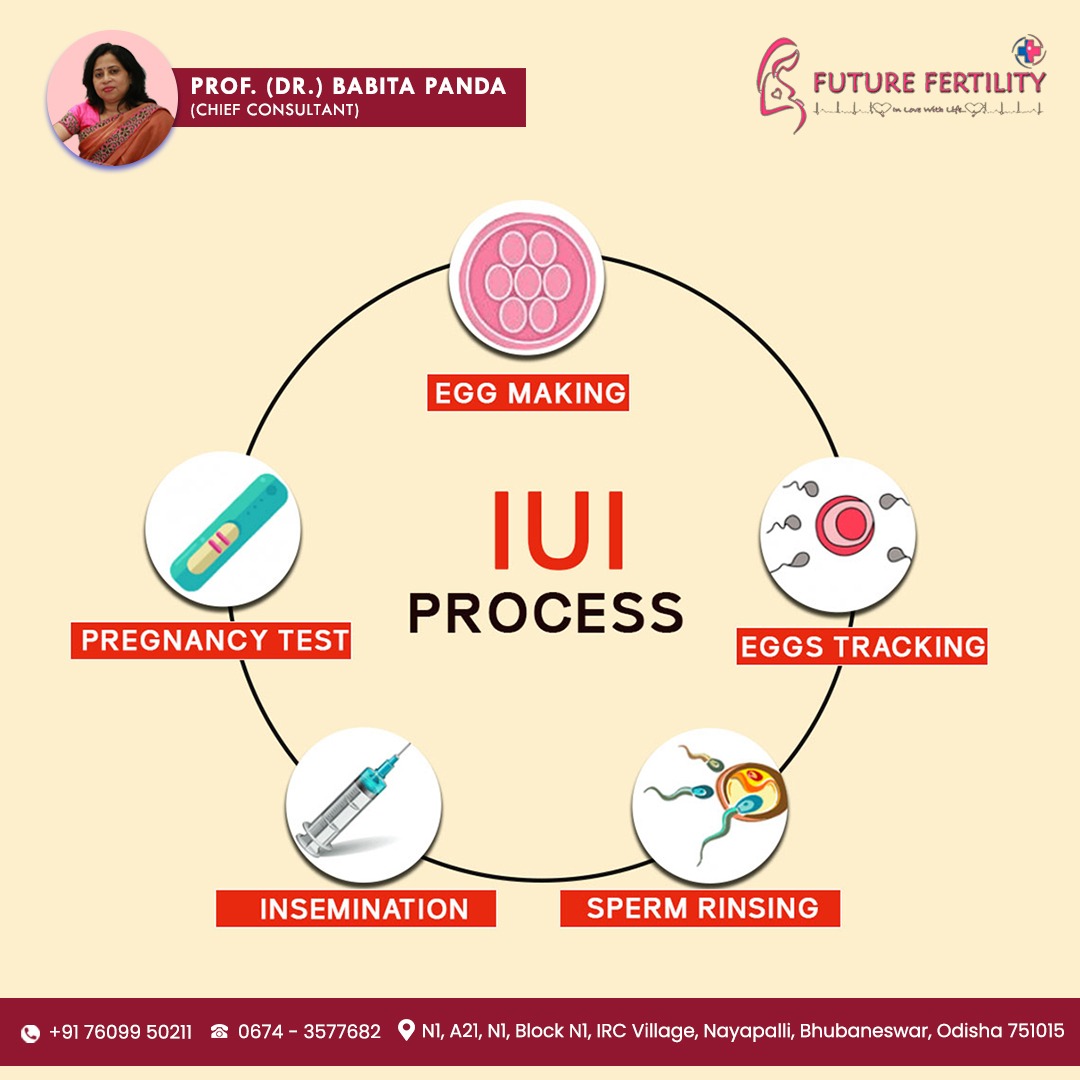 FutureIvf's tweet photo. For unexplained infertility, mild endometriosis, or minor male factor infertility, IUI is the first-line treatment. It is less expensive than IVF...
#FutureFertilityIVF #fertilitytreatment  #health #fertilityclinic #bbsr #pregnancy #success #successrates #lifeandhope #motherhood https://t.co/Gx3nfW17B1