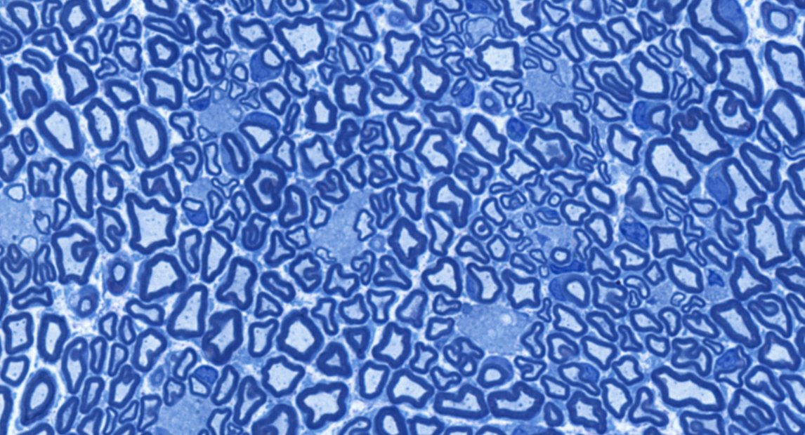 Rüegg Lab (@ruegglab) on Twitter photo Linker proteins not only correct muscular dystrophy but also nerve pathology in mouse models for LAMA2 MD/MDC1A. See our latest preprint: biorxiv.org/content/10.110…
Thanks to Emanuela and Stefano <a href="/previste/">Stefano Previtali</a> from the Previtali lab for the great collaboration. Linker proteins not only correct muscular dystrophy but also nerve pathology in mouse models for LAMA2 MD/MDC1A. See our latest preprint: biorxiv.org/content/10.110…
Thanks to Emanuela and Stefano <a href="/previste/">Stefano Previtali</a> from the Previtali lab for the great collaboration.