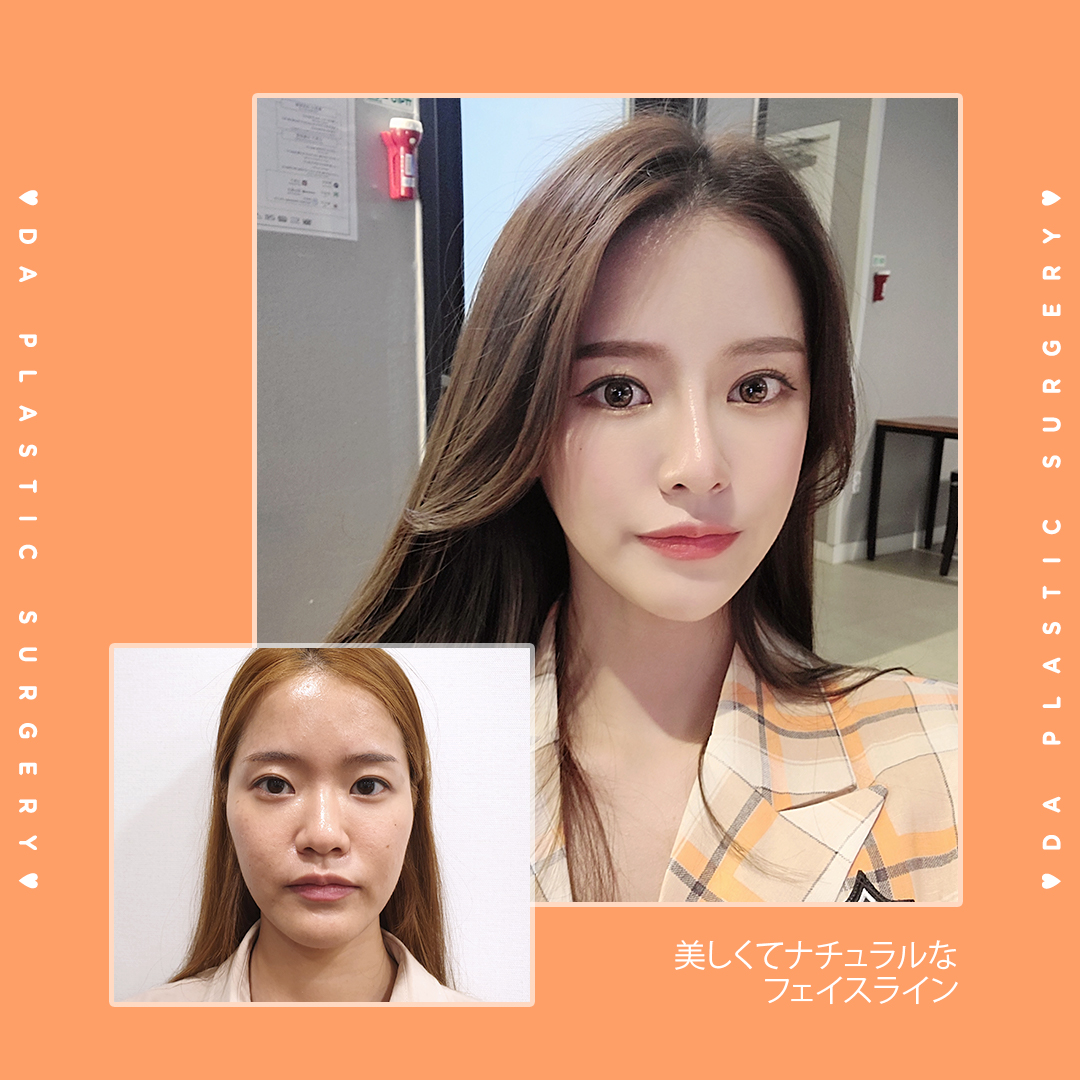 可愛くなりたい人と繋がりたい Twitter Search Twitter