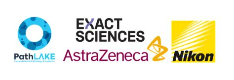 BPRGUoN's tweet photo. Thank you to our sponsors of the #breastpathology #masterclass 2022 series - @AstraZeneca @ExactSciences @UKNikon @PathLAKE_CoE We're delighted you're partnering with us! https://t.co/WNFaiwUikc https://t.co/Y0C03Q6tkR
