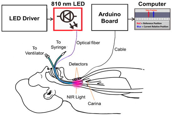 Biosensors_MDPI's tweet photo. #Article  
📢 Real-Time #Optical Monitoring of Endotracheal Tube Displacement 

Read more: https://t.co/CjehvGTcRp

#endotrachealtube
#displacementmonitoring
#fiberopticsensor https://t.co/RYUk3J6vnf