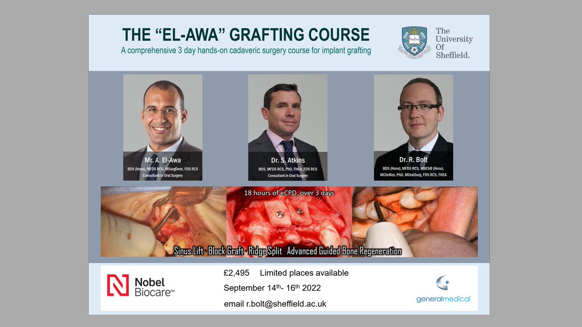 A comprehensive 3 day hands-on cadaveric surgery course for implant grafting, covering sinus lifts, block graft, ridge split and advanced GBR. 14-16 Sept 2022. 

REGISTRATION OPEN.

<a href="/sheffielduni/">The University of Sheffield</a> <a href="/ShefDentistry/">School of Clinical Dentistry | Sheffield</a> <a href="/BAOS_UK/">British Associaton of Oral Surgeons</a> <a href="/jtg_baoms/">Junior Trainee Group - BAOMS</a> <a href="/BAOMSOfficial/">BAOMS</a> <a href="/NobelBiocareUK/">Nobel Biocare UK</a>