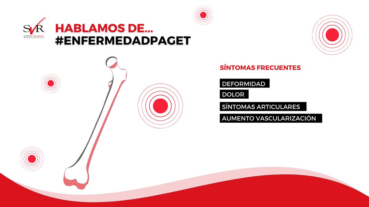 svreumatologia's tweet photo. #Hoyhablamosde…

🦴 Hoy os hablamos de la enfermedad de #Paget. Se trata del trastorno óseo más frecuente, después de la osteoporosis. Esta enfermedad genera una alteración en el tamaño del hueso, que deriva en una deformación secundaria. https://t.co/PrNqHgXICp