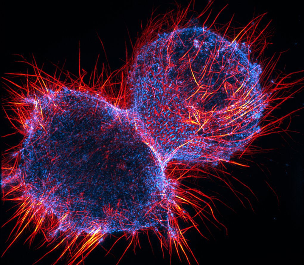 MAG2ART's tweet photo. A dividing cell photographed through a microscope. Actin and myosin II filaments are shown.
#Science #Biology #CellBiology #Art https://t.co/73ME0rnPf0
