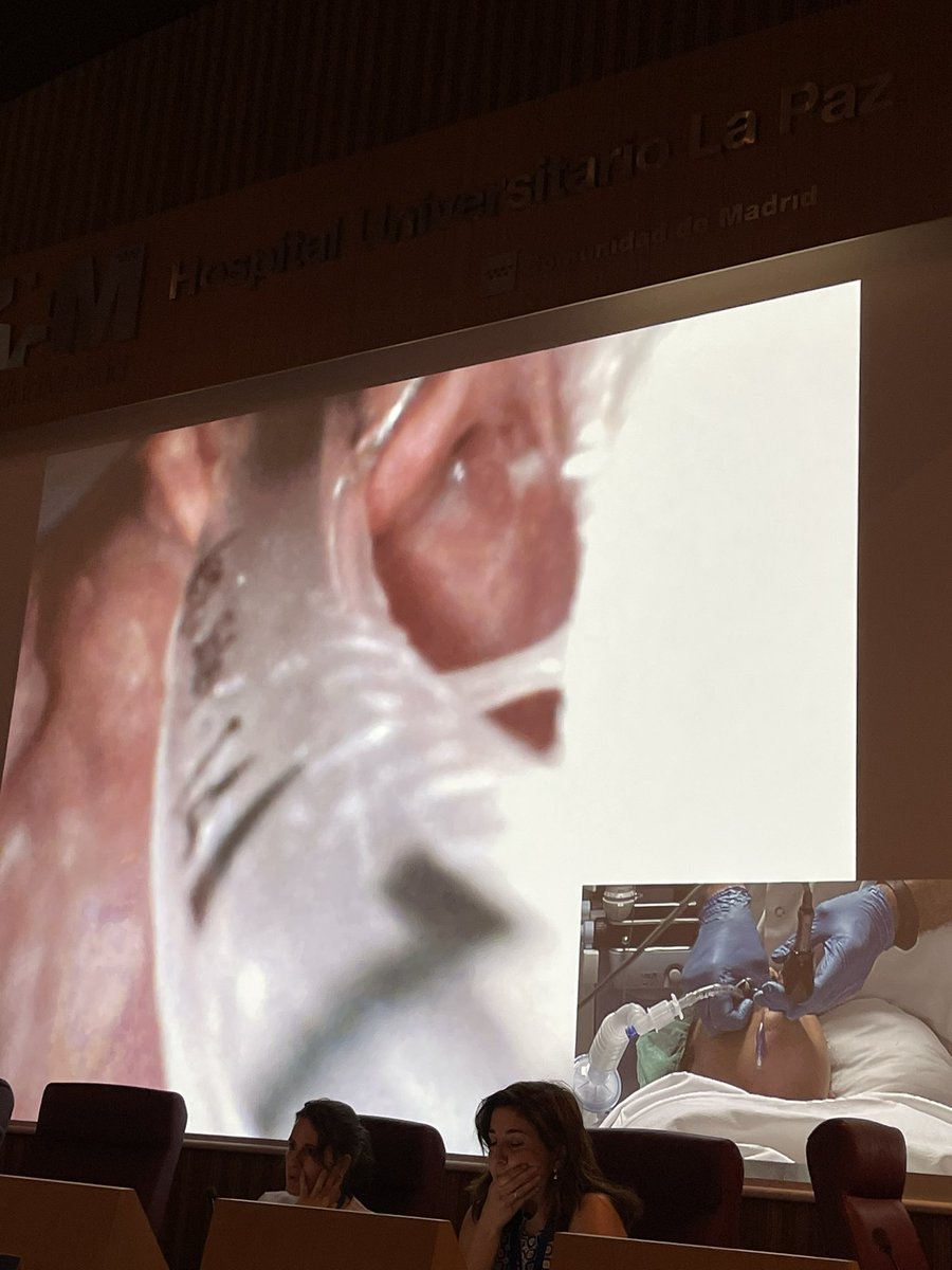 dr_imranahmad's tweet photo. #simuvad2022 #simuvad @AirwayMxAcademy @fibroanestesia @stateless79 @navarroguillej fabulous session of live advanced airway procedures professionally and expertly demonstrated by the hugely impressive and skilful team in theatres..a hidden gem, world class session!! 👏🏽👏🏽 https://t.co/nqxREhi0dp
