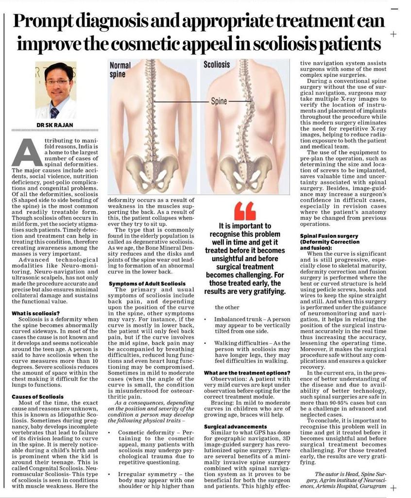 AgrimNeuro's tweet photo. Prompt diagnosis and appropriate treatment can improve the cosmetic appeal in scoliosis patients.
-An article by Dr SK Rajan (chief-Neuro Spine Surgery and Add. Director-NeuroSurgery). https://t.co/zgnGE64WNd