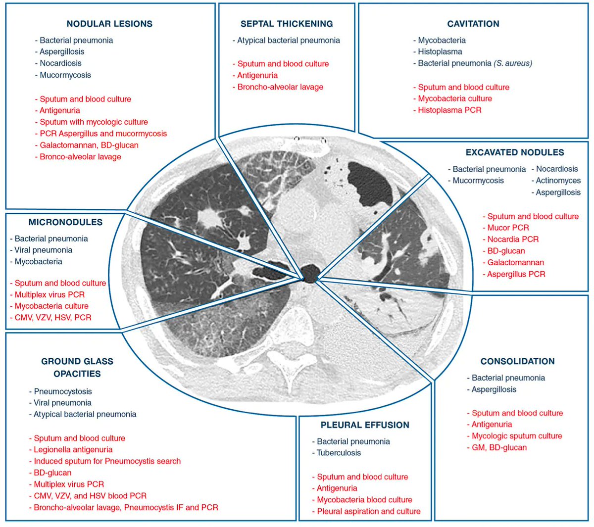 MedClubPage's tweet photo. #Infectología #Neumología
Probables etiologías de infección pulmonar de acuerdo al patrón tomográfico.
Intensive Care Med. 2020;46(2):298-314. doi:10.1007/s00134-019-05906-5 https://t.co/wr2vADXjzx