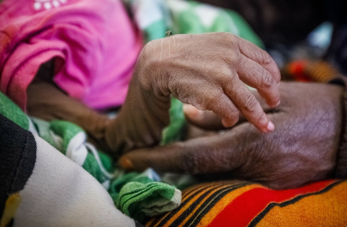 OxfamIntermon's tweet photo. La población de Africa Oriental sufre una grave crisis alimentaria. También el Sahel. Millones de personas pasan hambre y muchas están muriendo.
Actuamos sobre el terreno, pero también pedimos a los gobiernos que se movilicen urgentemente.
#NoMásRetrasos 
https://t.co/sfRLs7FALd https://t.co/GK5gZrFMHi