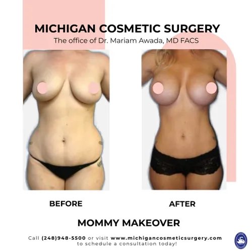 drmariamawada's tweet photo. It's #FeelGoodFriday! To all the mommies out there that are unhappy with their post-pregnancy bodies, the Mommy Makeover was designed for you! Schedule your consultation now at the Michigan Cosmetic Surgery.  ☎️ (248) 948 - 5500  🌐 https://t.co/IZQG5NUG7H https://t.co/GwJqwqY8sX