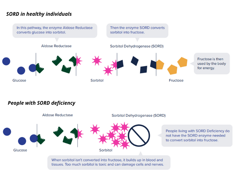 CMTRF's tweet photo. Our Chief Scientific Officer (CSO), @KeithNFargo, discusses the SORD gene, its discovery and relation to CMT, as well as why the pace for clinical trials have been able to move so quickly.
To read more, visit: https://t.co/WpGJIlswIc https://t.co/8YVnTHFkEE