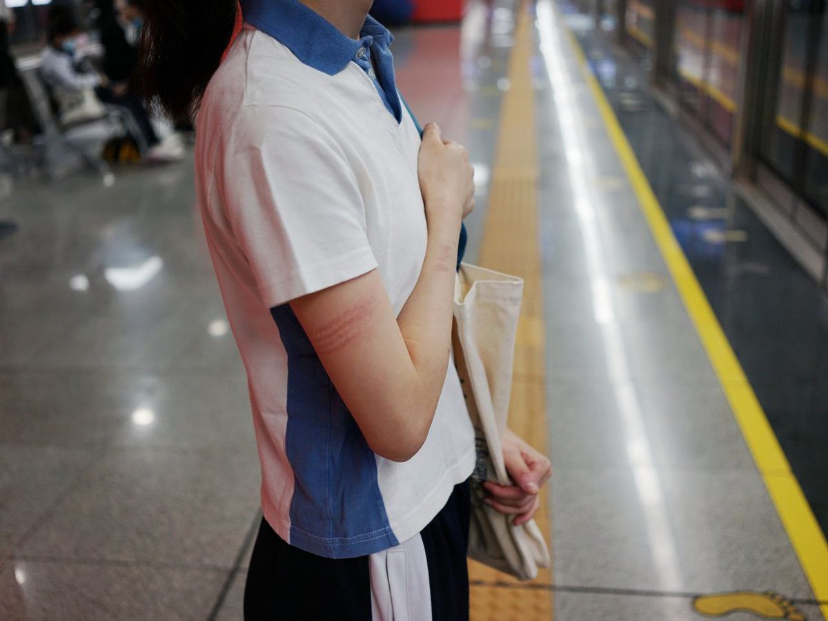 Qiaobenxiaoxing's tweet image. 学生妹手上的痕迹怎么来的啊？ #学生 #校服