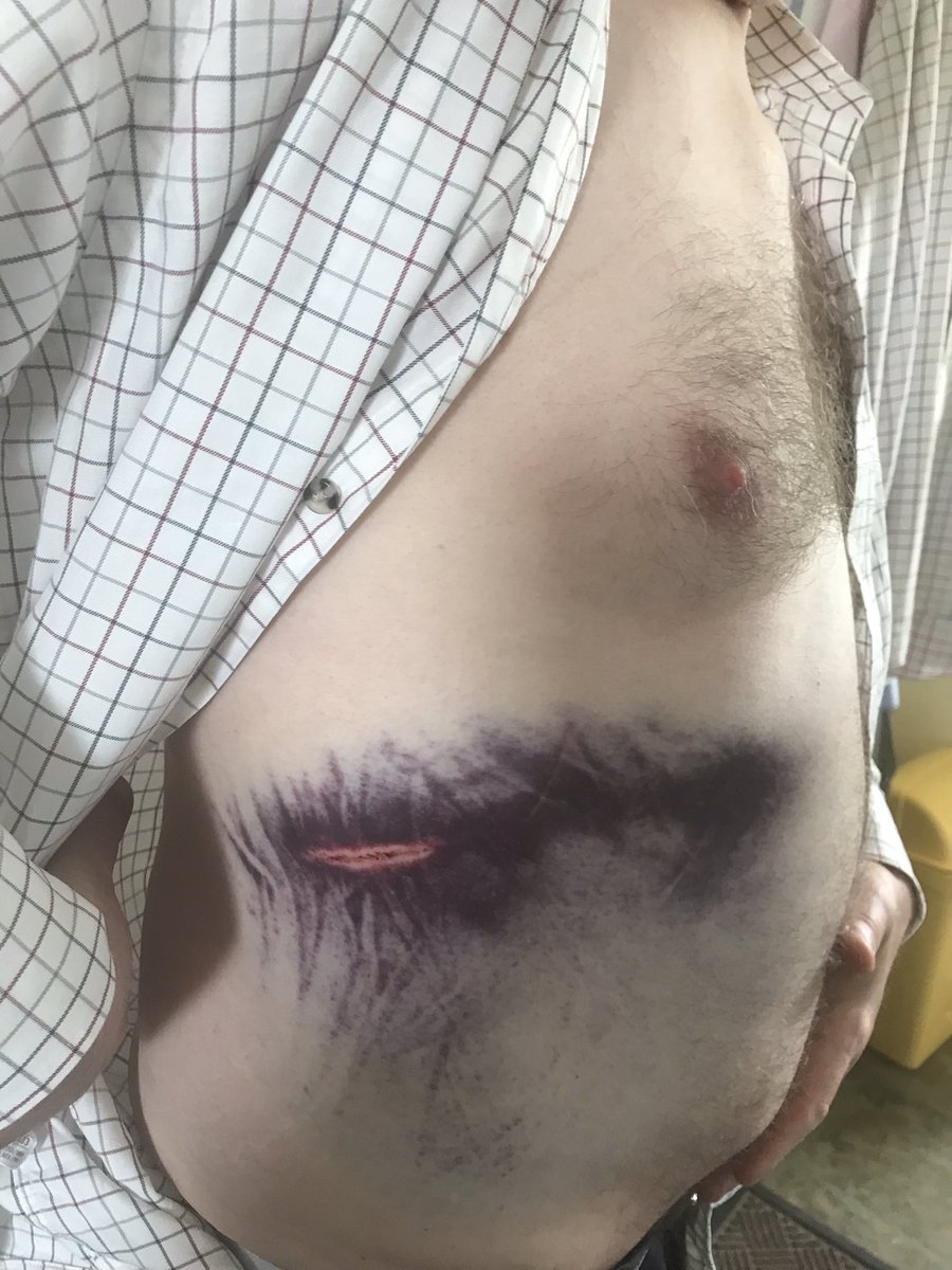 My trip to Sevilla began so well, great days in Faro then Seville had a brilliant time until I complained about dehydration and the appalling lack of water. Didn’t get a polite reply, a baton to the ribs. 
 <a href="/UEFA/">UEFA</a> and <a href="/SevillaFC_ENG/">Sevilla FC</a> made huge mistakes, Hampden next #Rangers