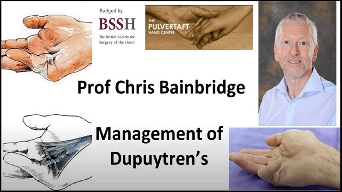 ipokrate's tweet photo. Management of Dupuytren's Contracture by Prof Chris Bainbridge
Watch and learn today from the Pulvertaft Videos series on "Management of Dupuytren's contracture".
https://t.co/jWcO5ilRgb
#ipokrate #conference #doctor https://t.co/jJZfPnnjxT