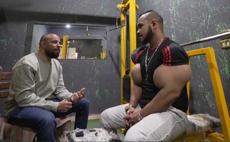 KARIMDDKK's tweet image. Why people do this to them self! Looks so disgusting this is oil and not muscles 🤦🏽‍♂️
#synthol