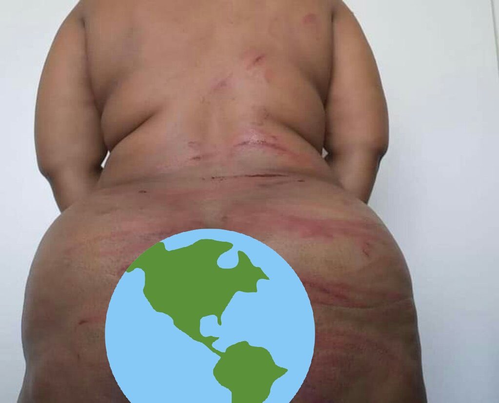 yozah__m's tweet photo. @Thembisile_Q @noxolo_n_ She begged for her life! She pleaded for her life. He beat her up and left her to die! She went home to her family, and was shot dead 9times outside her home! #MajorMfesaneBhekizulu still walks free! @SAPoliceService did NOTHING! #bhekicele we need answers!! #Justicefornamhla https://t.co/BJp8maMx3U