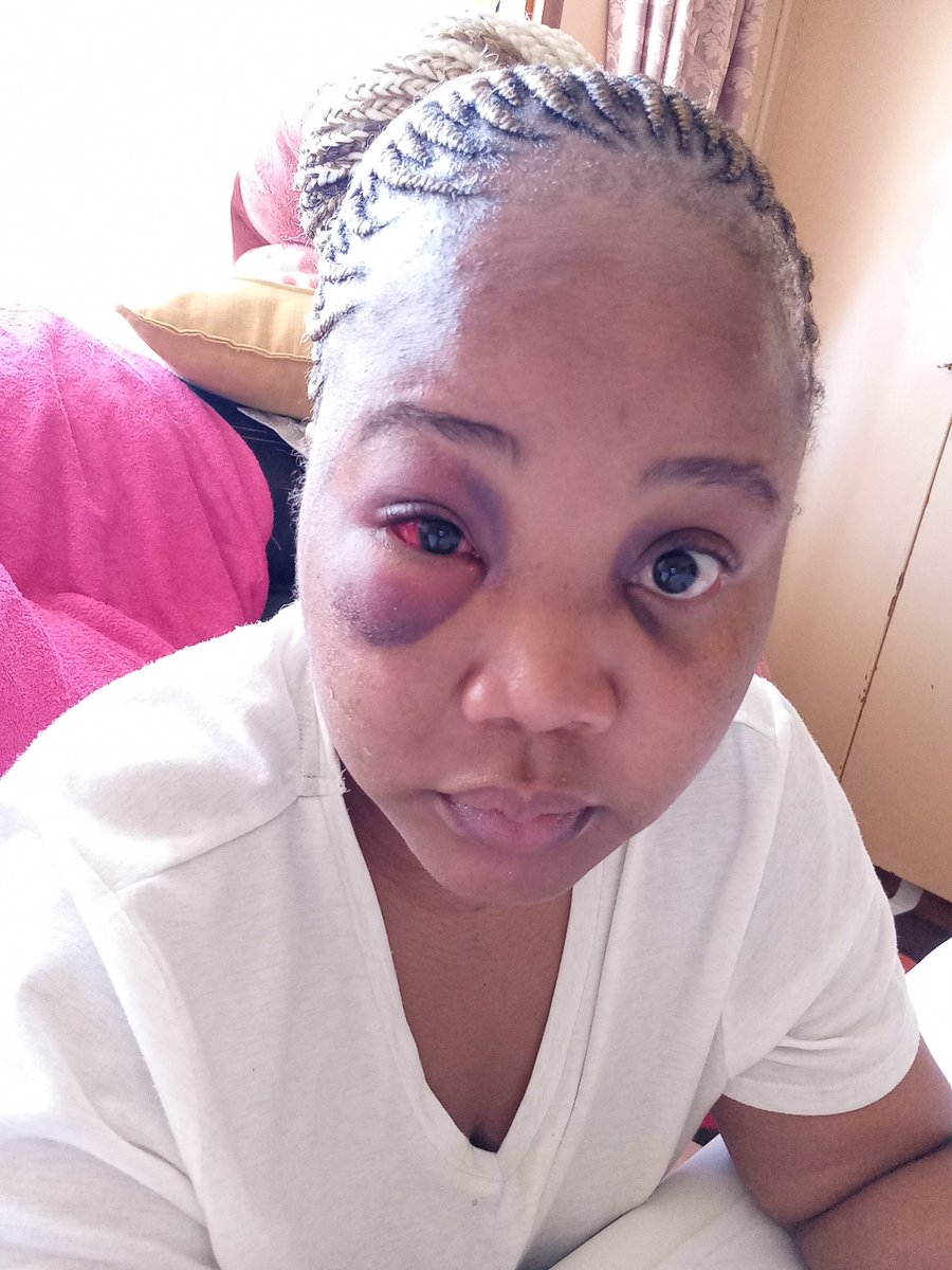 AneleMda's tweet photo. A 17 year old relationship which emotionally bruised, psychologically tormented &amp; physical tortured and abused Namhla..A life lived in misery &amp; fear, a voice of a woman totally KILLED, a human being SILENCED &amp; SUFFOCATED
Shot 9 times and killed 💔🙆🏾‍♀️😥

#justicefornamhla https://t.co/WlJ96lxLLS