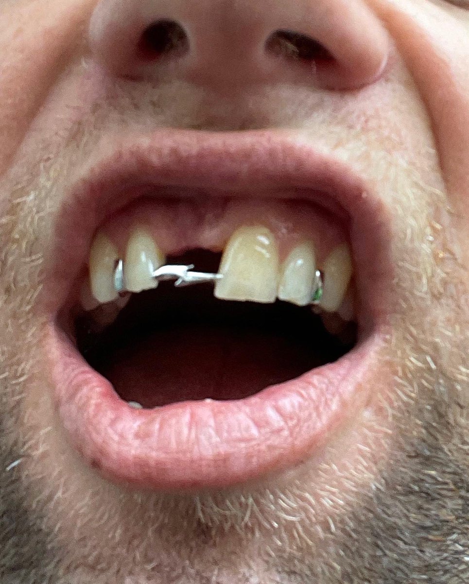 toby1tooth's tweet photo. https://t.co/yVDFFq7mKm