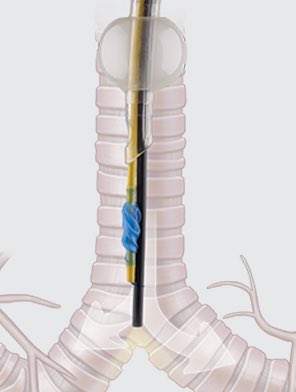 MU Pulmonary Critical Care Fellowship tweet media