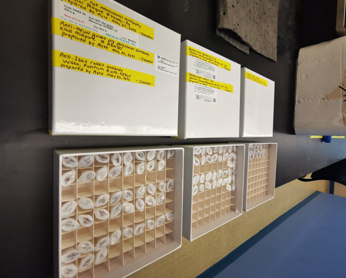 AyseAysuMalci's tweet photo. Have missed being at the bench! ❤️ Stay tuned for the fluorescence tweets, antibody aliquots are ready! 🧠🔬 #benchscientists #neuroscience #FluorescenceFriday @sidorovlab @ChildrensNatl https://t.co/Qsqlkp1X6J