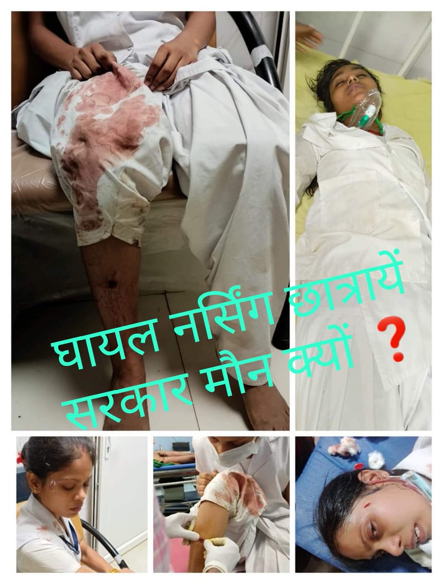 GnmStudent's tweet photo. @NitishKumar Thora hamare bare me v soch len @NitishKumar  ji Aapko sabka problem dikh rha hai hamara nhi dikh rha hai Aap apne dream project ko pura karne ke chakkar me Ham 200 GNM students ka life tabah kiye ja rhe hai hamlog pe lathicharge karwaye wo v male police ke through, kaise CM h ap https://t.co/0BhH9jTZAq