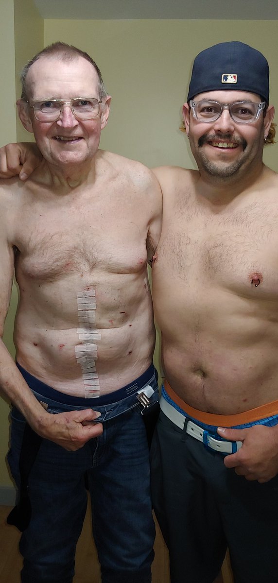 17 days post surgery. Optimistically cancer free LETS FUCKING GO.