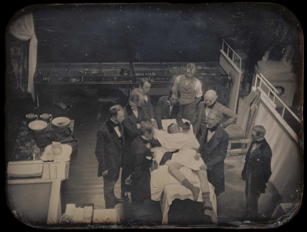 historydefined's tweet photo. The first known photo of an actual live medical operation, 1847. https://t.co/uKsoItztel