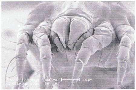 housedustmite's tweet photo. The fact that HDMs eat their droppings raises an important question. What in the mite's saliva neutralises the powerful digestive enzyme/allergen (Der p1) preventing it from harming the mite? Holy Grail in disarming the mite #EAACIMCA22 Ref J Insect Physiology,2021: 133, 104285 https://t.co/7HmDskbaoZ