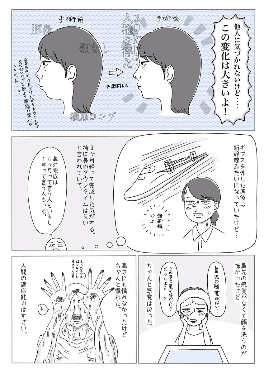 30すぎて初めて整形した話 最終回 (1/2) 