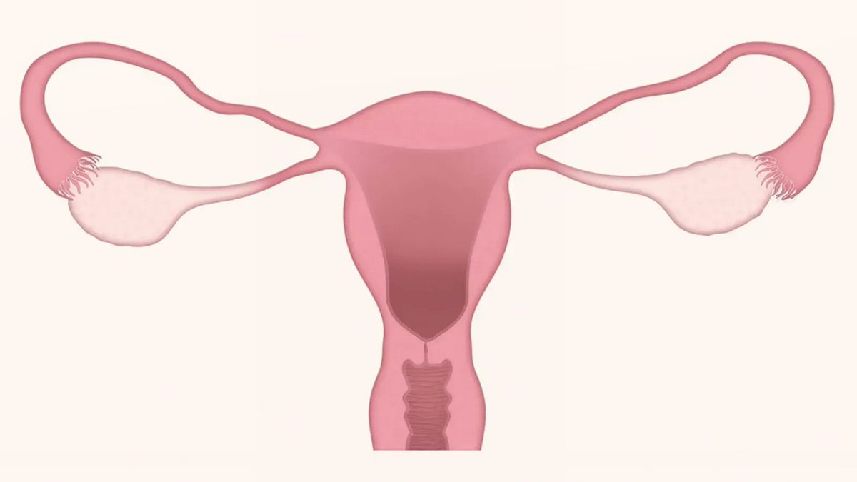 H1Connect's tweet photo. #Infertility & thin #endometrium: @p_saunder recommends this paper by Xirong Zhang et al. published in @FASEBorg that uses single-cell RNA sequencing to provide valuable information about the mechanisms of impaired receptivity in #ThinEndometrium.
https://t.co/BUqXOPNore https://t.co/b9X4niS4EO