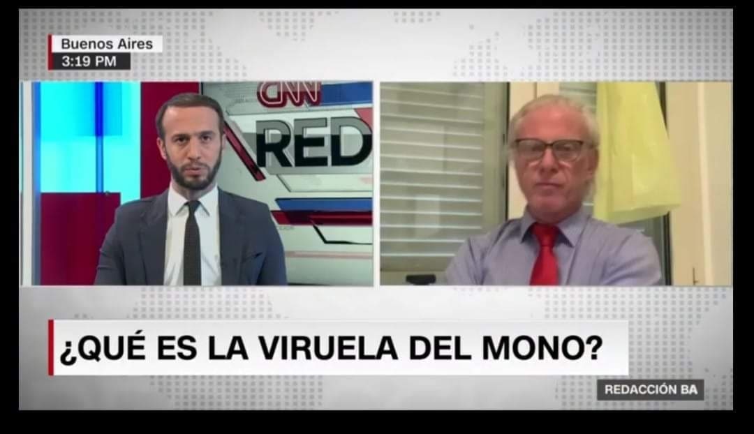 fondation_AHN's tweet photo. Interview de Dr. Pablo Goldschmidt, médecin expert de la Fondation Aua Help Noma A.H.N à CNN sur virus MONO Le virus Mono, cause la mononucléose infectieuse (mono, ou maladie du baiser). L'infection au VEB se manifeste habituellement dans l'enfance.
https://t.co/SKquLG8rf8  #AHN https://t.co/oU3MwcjToz