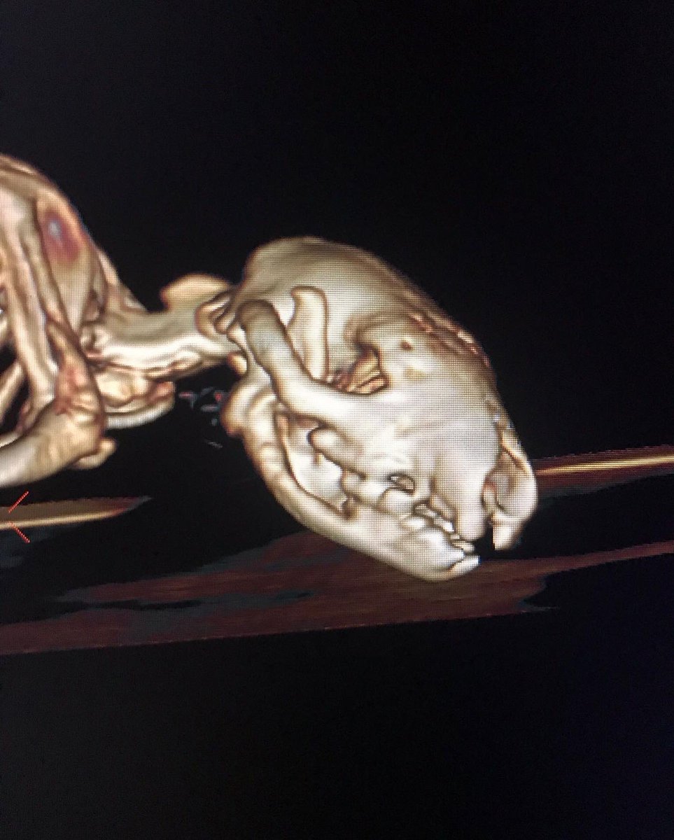 Wild Hogs Hedgehogs Rescue tweet media