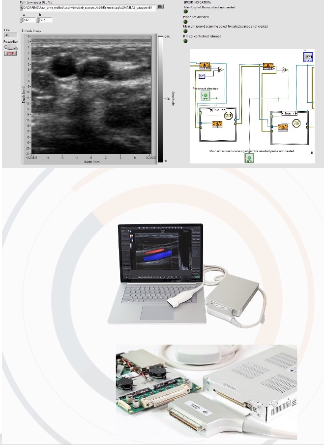 Telemed15's tweet photo. TELEMED releases a dynamic link library that allows to call SDK functions, perform real-time ultrasound image data acquisition and imaging from the other programming platforms such as MATLAB, Python etc. 
DLL is compatible with Telemed SDK available for ArtUs, SmartUs and MicrUs. https://t.co/uDTMGWiZdv
