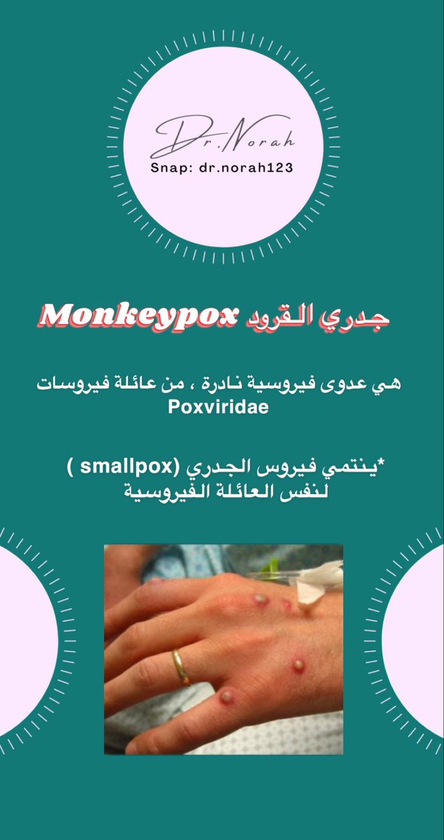 drnorah123's tweet image. #جدري_القردة 
#monkeybox