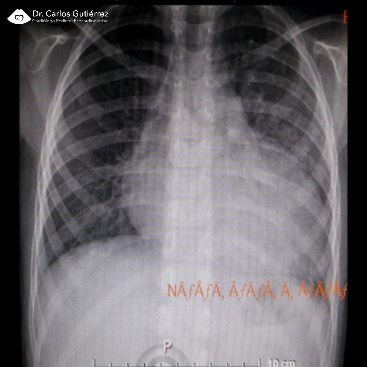 Dr Carlos Gutiérrez Torpey tweet media