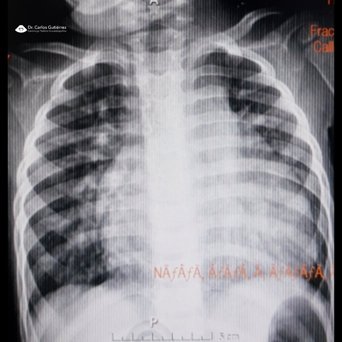 Dr Carlos Gutiérrez Torpey tweet media