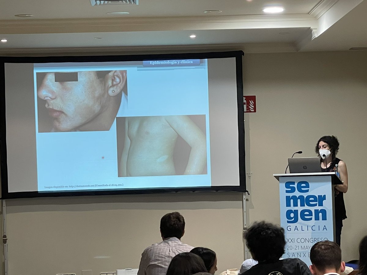 DanielReyAldana's tweet photo. Taller sobre dermatoscopia para #AtencionPrimaria y manejo del paciente con #dermatitisatopica en #Semergengal22 https://t.co/xyjG2k3oeR