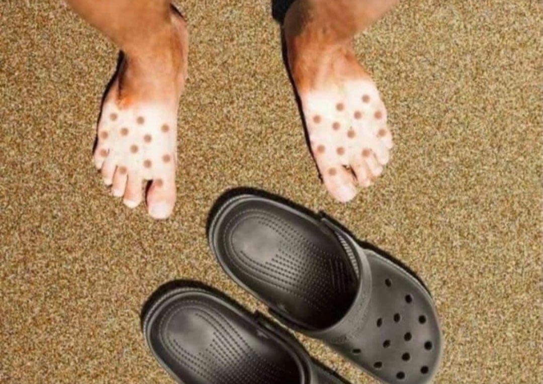 t23_miss's tweet photo. Croc Pox 😳 https://t.co/YtIceexKZF