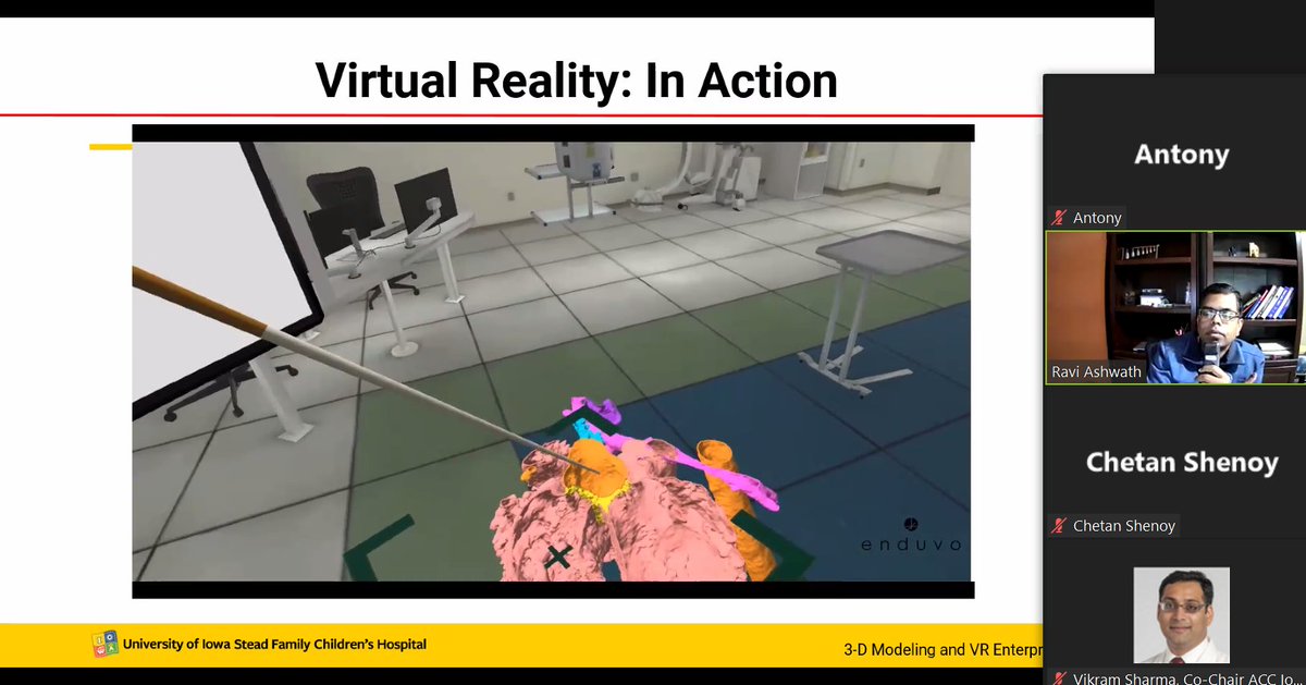 Utility of VR (virtual reality) &amp; 3D imaging in complex congenital heart disease <a href="/RaviAshwath1/">Ravi Ashwath</a> #IowaACCLectures #ACCFIT #ACCEarlyCareer #letslearncardiology
<a href="/ACCinTouch/">American College of Cardiology</a>
<a href="/SCMRorg/">Society for Cardiovascular Magnetic Resonance</a>
<a href="/Heart_SCCT/">Heart_SCCT</a>