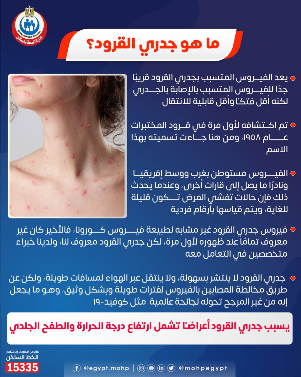 معلومات هامة عن جدري القرود…