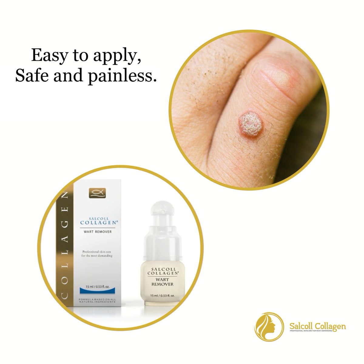 OfficeSalcoll's tweet photo. Due to the mutually complemented actions of lactic acid &amp; salmon collagen, this plantar wart remover easily penetrates the most callous warts.
------
Shop Now : https://t.co/cAa4Ms99D3
.
#salcollcollagen #wartremover #plantar #wartregrowth #warts #facial #skincare #wartsremoval https://t.co/vZ89OtHxqh