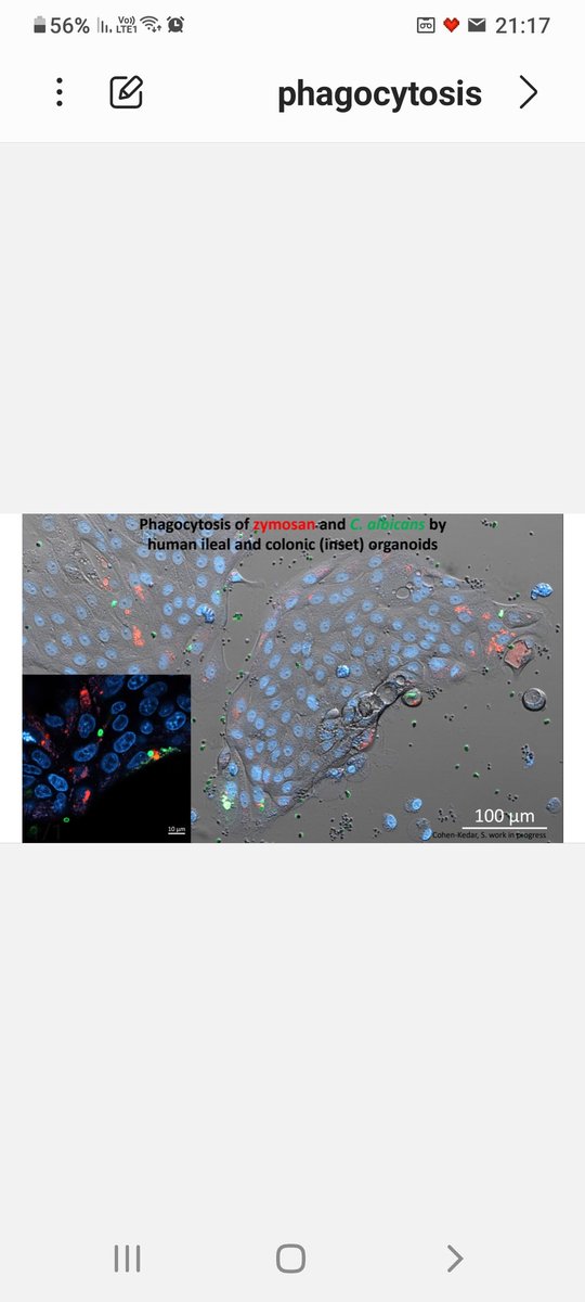 Iris_Dotan's tweet photo. @MicroMindy Human #epithelial cells  #phagocytosis of #glycans #fungi in #gut homeostasis ( and implications for #IBD?..)
@CohenKedar @GastroRMC #FluorescenceFriday https://t.co/DwGHgNBD6b