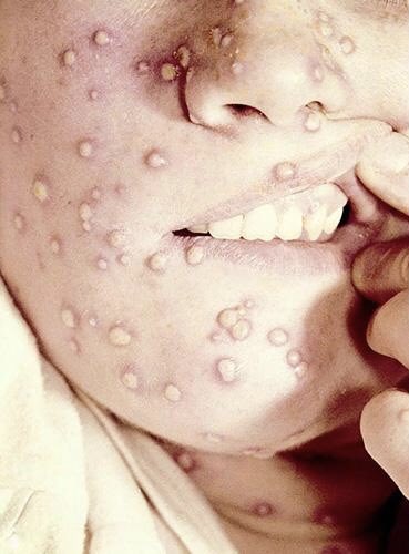 Tracey Lecointe MCCT tweet media